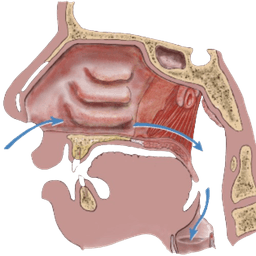 Hypernasal Speech Therapy