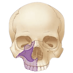 Maxillectomy
