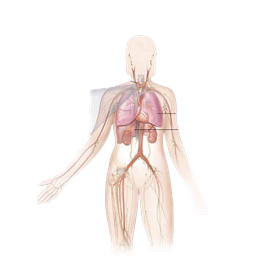 Medullary Carcinoma