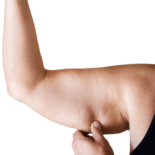 Lob qo'g'risi liposaksiyasi (Qov yog'ini liposaksiyasi)