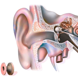 Myringotomy