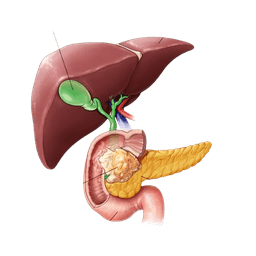 Pancreatic Cancer