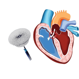 PDA Device Closure
