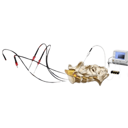 Radiofrequency Ablation