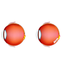 Retinoblastoma-RB