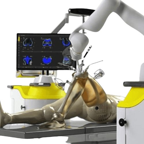 Robot yordamida tizzani almashtirish jarrohligi