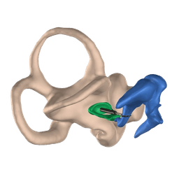 Stapedectomy