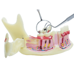 Tooth Reshaping & Dental Contouring