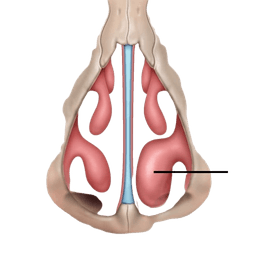 Turbinoplasty