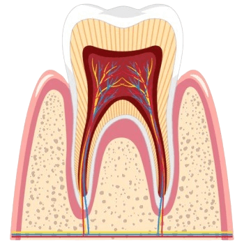 Apicoectomy