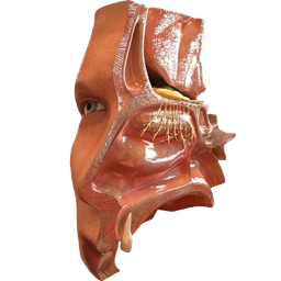 Endoscopic Turbinectomy