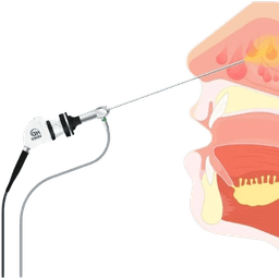Image Guided Endoscopic Nasal & Sinus Surgery