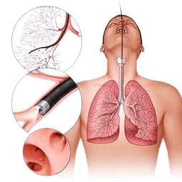 Laryngoscopy