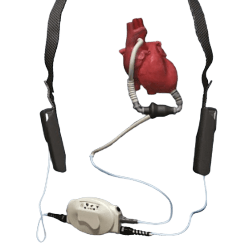جهاز دعم البطين الأيسر LVAD لفشل القلب المتقدم