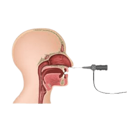 Nasopharyngoscopy