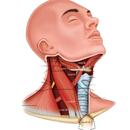 Neck Dissection Surgery