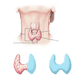 Thyroidectomy Surgery
