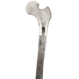 Bone Marrow Cancer