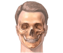 Craniofacial Reconstruction Surgery