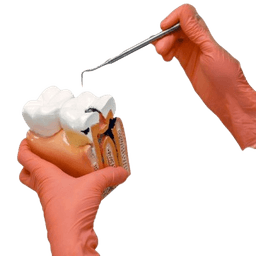 Dental Bone Grafting