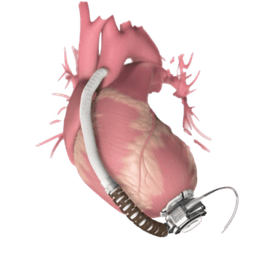 HVAD (HeartWare Ventricular Assist Device)