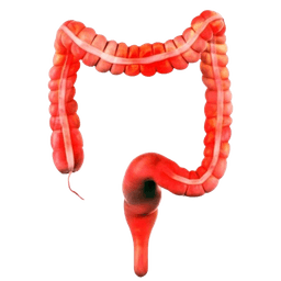 Irritable Bowel Syndrome-IBS